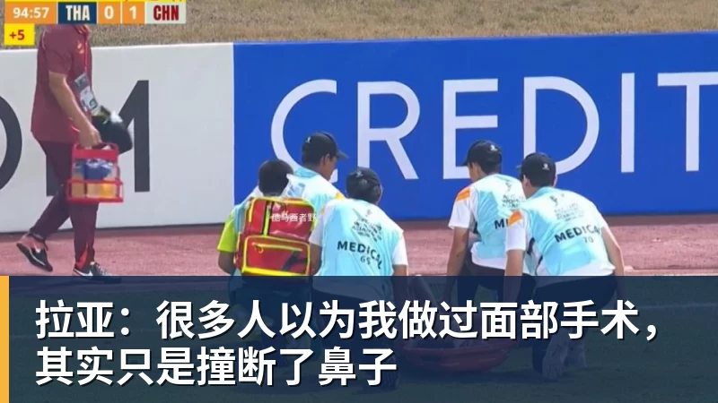 PG电子拉亚：很多人以为我做过面部手术，其实只是撞断了鼻子